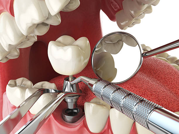 Best Broken or Cracked Tooth Emergency Dentist in Chesterfield, SC